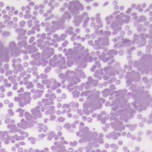 Crioaglutininas x40 | Banco de imagens hematologia