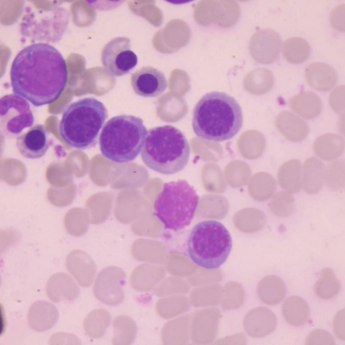 Eritroblastos | Banco de imagens hematologia