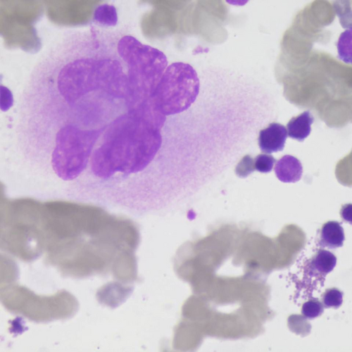 Megacariócito | Banco de imagens hematologia