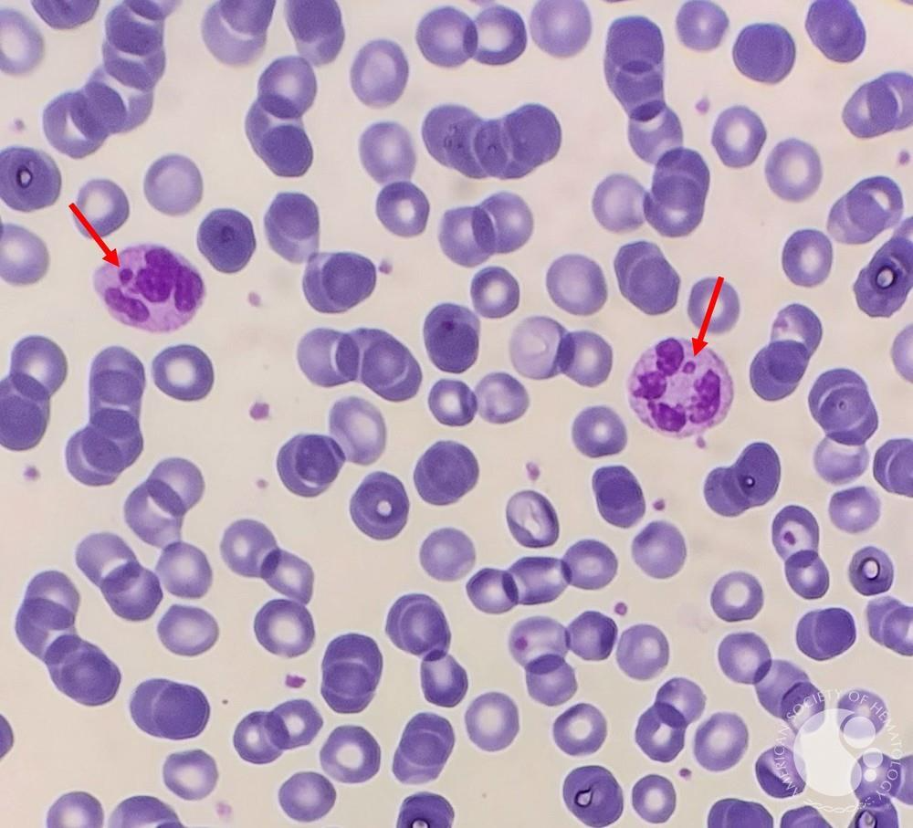 Baquetas | Banco de imagens hematologia