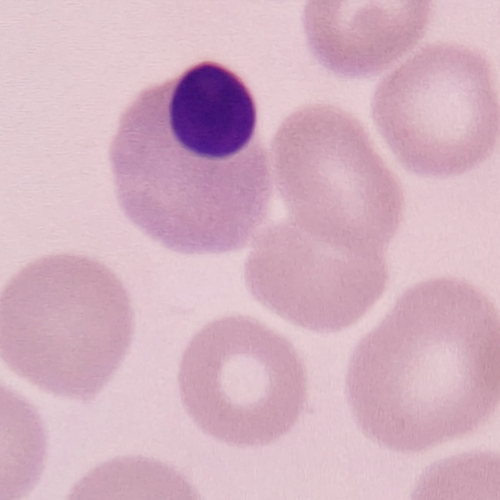 Eritroblasto | Banco de imagens hematologia