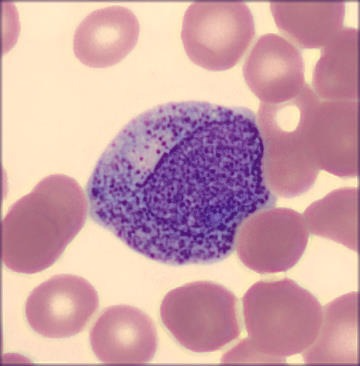 Promielócitos | Banco de imagens hematologia