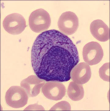 Promielócitos | Banco de imagens hematologia