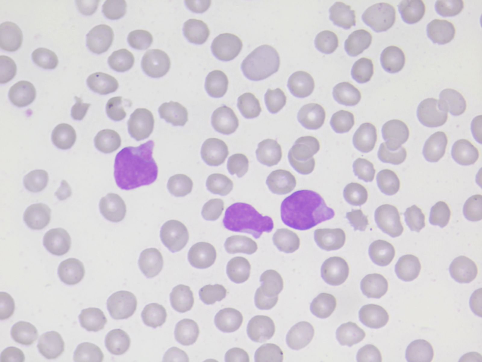 Blasto | Banco de imagem hematologia