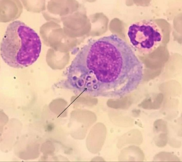 Histoplasma | Banco de imagens hematologia