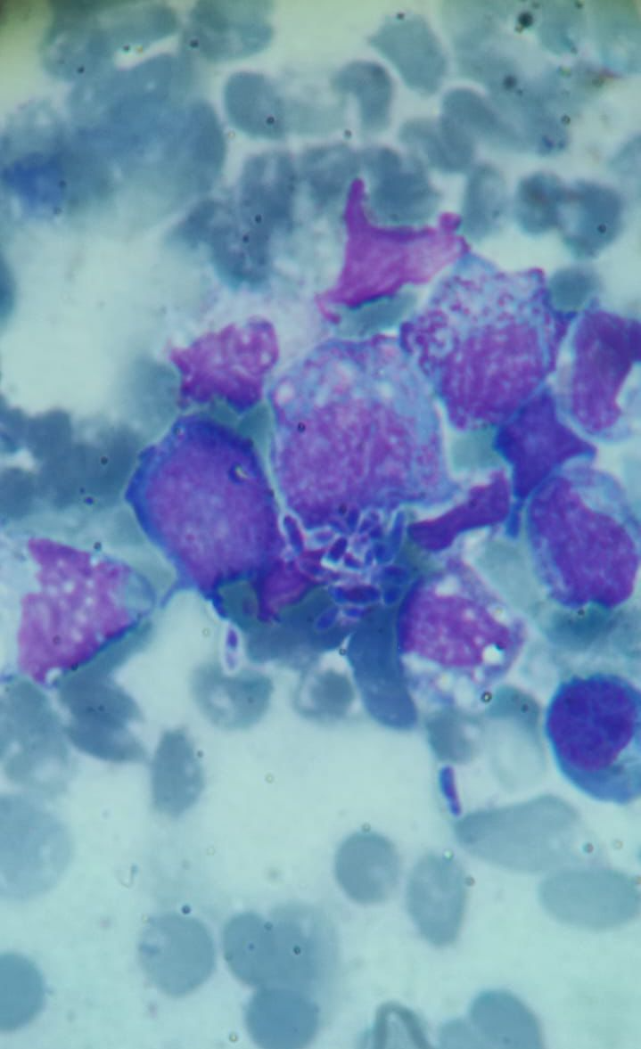 Microorganismo abba | Banco de imagens hematologia