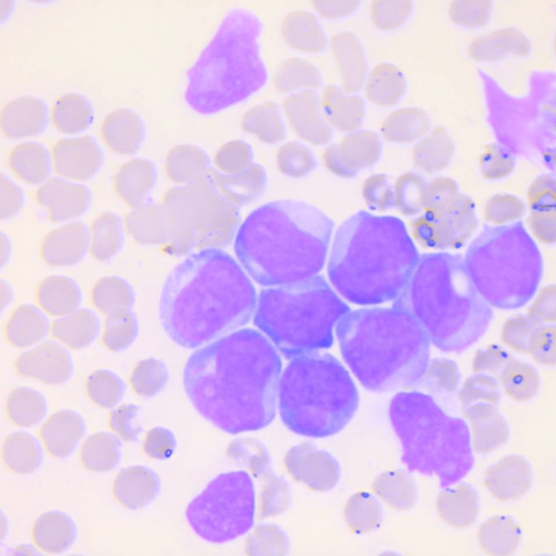 Blastos com Bastonetes de Auer